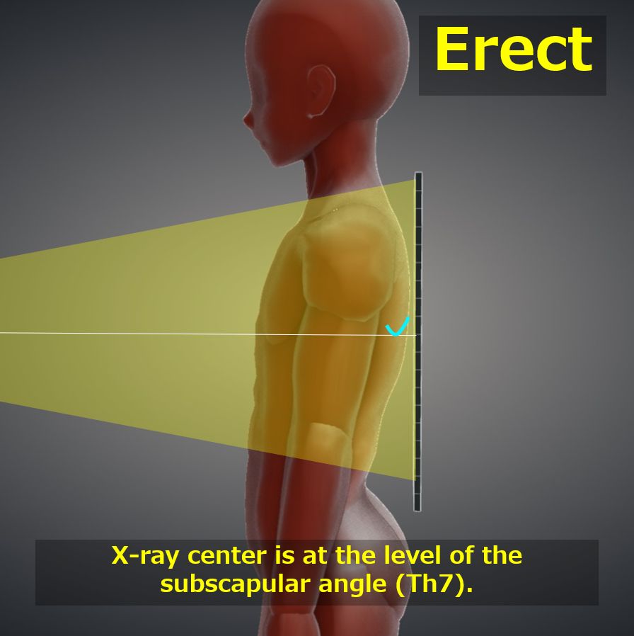 Cervical and Thoracic Spine - ppt download