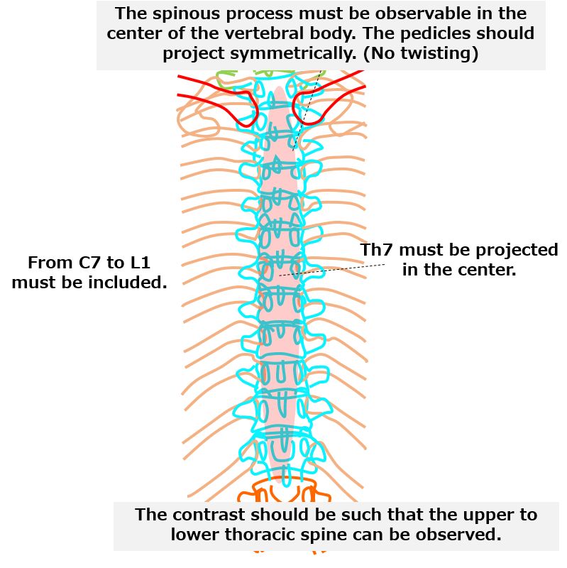 Dorsal/ Lumbar/ LS Spines - ppt video online download