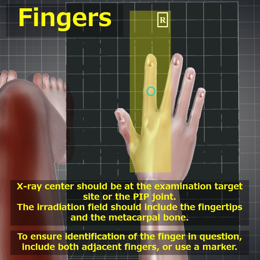 Finger_19