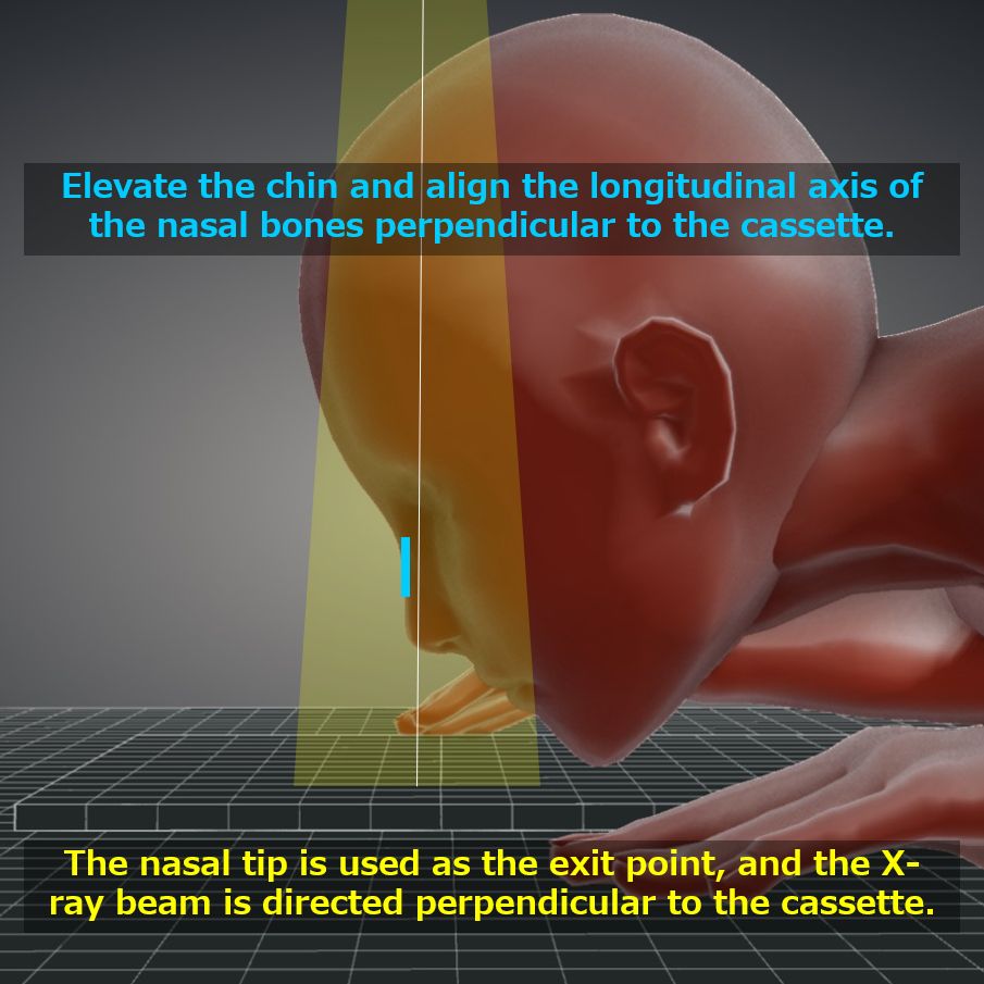 nasal bone x ray anatomy