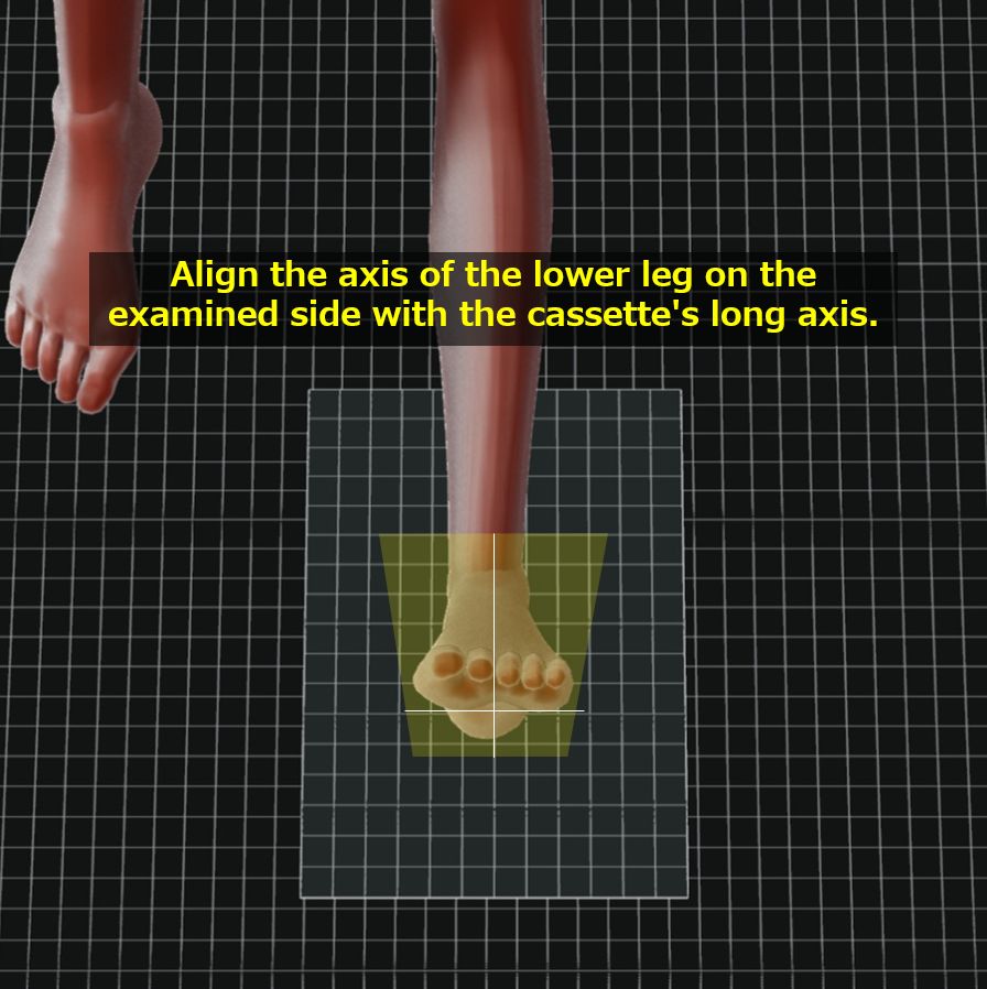 Axial view, T2-weighted image of lumbosacral spine, showing disk... |  Download Scientific Diagram