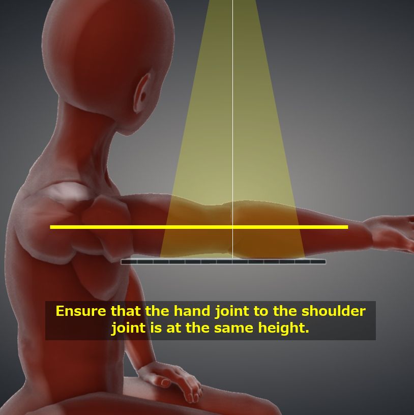 Elbow oblique view, Lateral rotation, External rotation｜Tools for RadTech