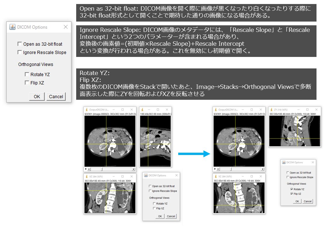 Imagej Tools ImageJの使い方 2 ーEditメニュー編ー|Tools for RadTech