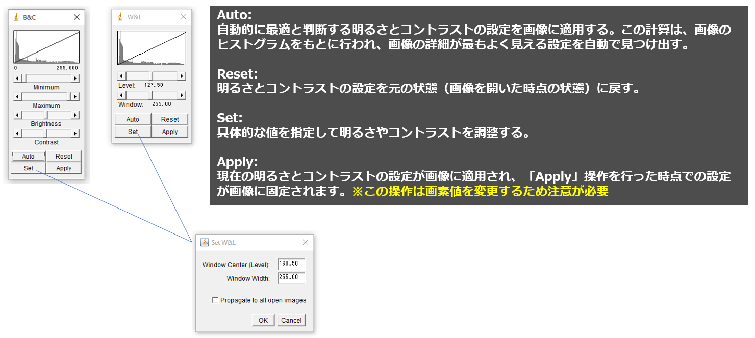 ImageJの使い方 3 ーImageメニュー編ー｜Tools for RadTech