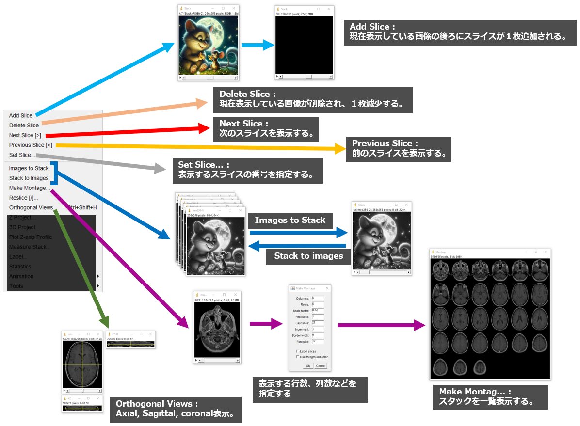 Imagej Tools ImageJの使い方 3 ーImageメニュー編ー|Tools for RadTech