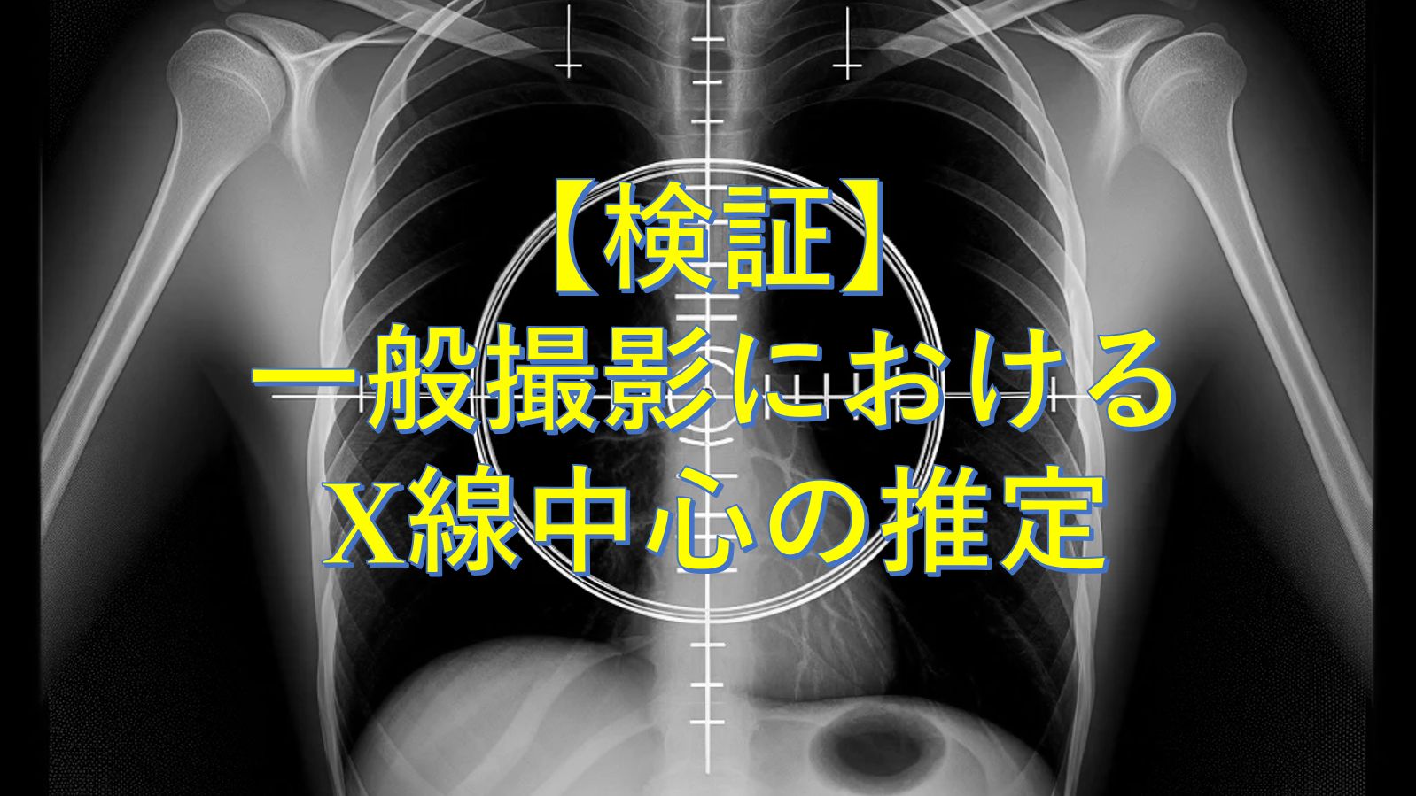 検証】一般撮影におけるX線中心の推定｜Tools for RadTech