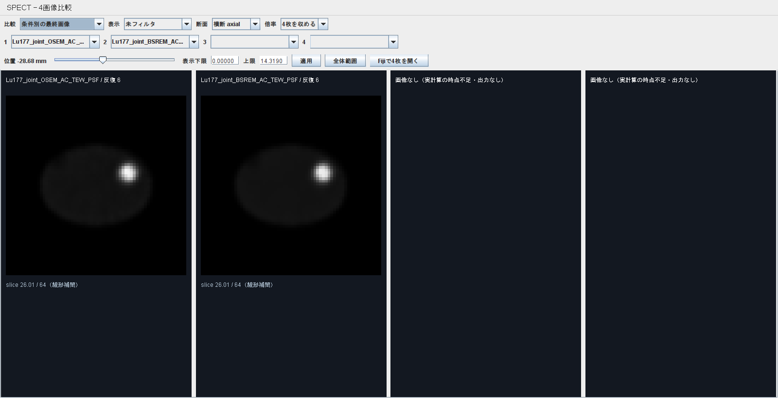 Lu-177 joint OSEMとBSREMの最終画像を同じ物理位置とWW WLで比較した画面